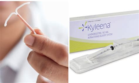 I switched over to a Kyleena IUD back in February of this year and around June I noticed I was starting to break out a lot. . Pregnant with kyleena iud reddit